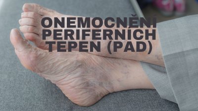Onemocnění periferních tepen (PAD): První kroky k prevenci a péči o vaše nohy | ARNO.cz - obuv s tradicí